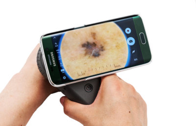Dermatoskop Illuco IDS-1100C s dokovací stanicí a universálním adaptérem na smartphone - 2