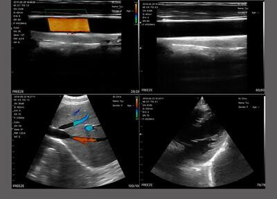 Bezdrátový ultrazvuk - 2v1 - 4