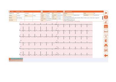 Přímopíšící Cardioline ECG200L FULL - 4